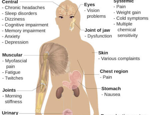 CBD FOR FIBROMYALGIA